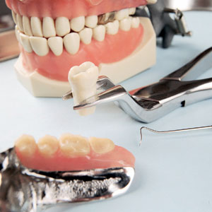 Протезирование зубов стоматология Мытищи м. Медведково